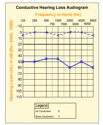retekess-tws-hearing-aids-2