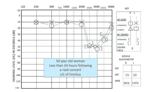 retekess-tws-hearing-aids-3